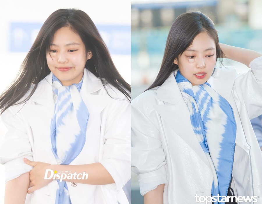 Tak Lagi Malu, Jennie PeDe Pamer Cedera di Bawah Matanya Saat Betolak Ke Paris