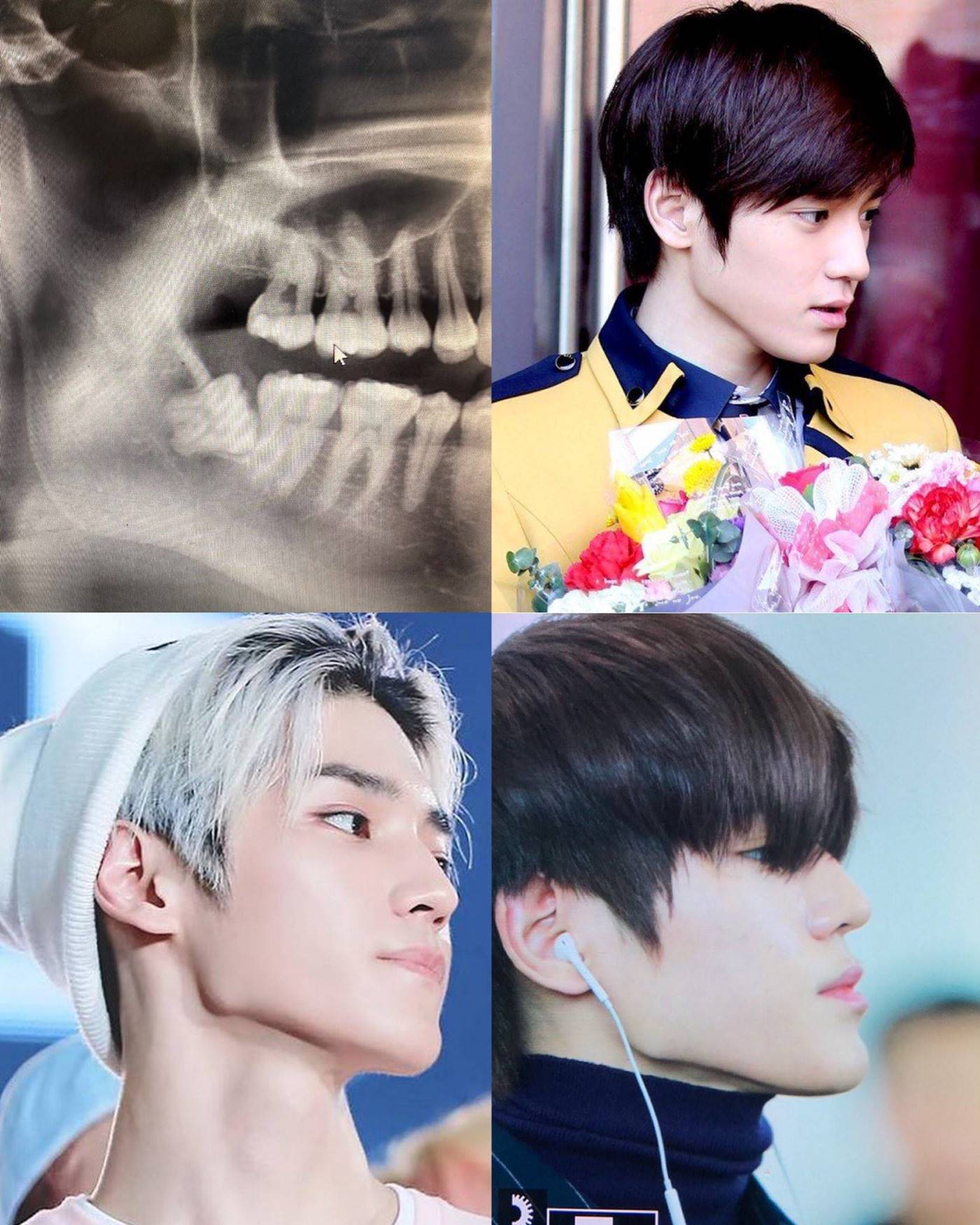 Perbandingan X-Ray dan rahang Taeyong NCT