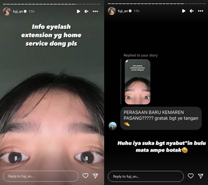 Fuji An Tunjukkan Kondisi Bulu Matanya yang Botak Gara-gara Ulah Sendiri