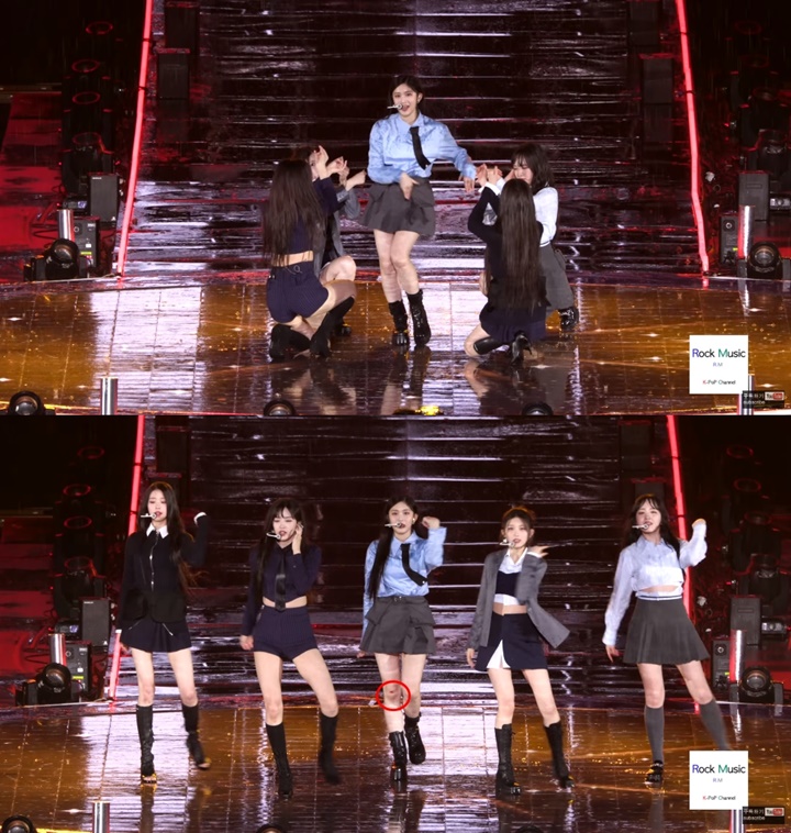 Leeseo IVE Terluka Hingga Berdarah di Atas Panggung