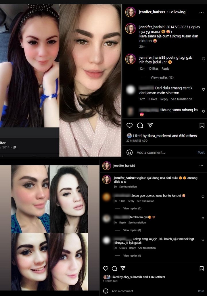 Bukti Jennifer Dunn Cantik Tanpa Oplas