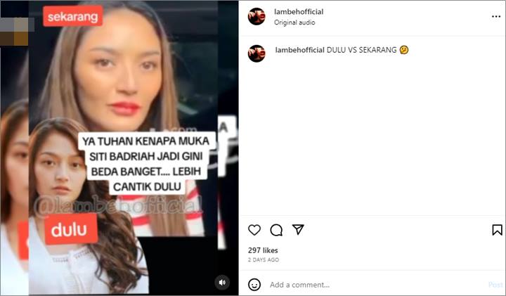 Wajahnya Dikira Kini Berubah, Siti Badriah Bongkar Faktanya