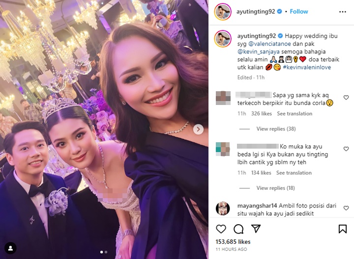 Ayu Ting Ting Disangka Oplas Gegara Wajah Berubah Aneh Kala Foto Bareng Kevin Sanjaya