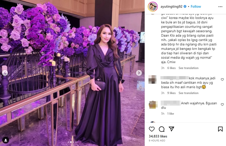 Ayu Ting Ting Disangka Oplas Gegara Wajah Berubah Aneh Kala Foto Bareng Kevin Sanjaya
