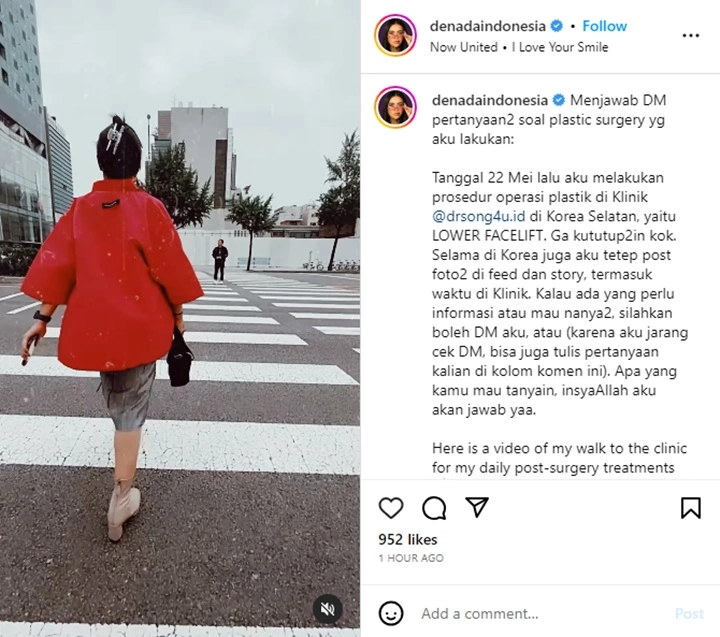 Denada Bagikan Video Saat Jalani Oplas di Korea, Akui Gelontorkan Banyak Uang