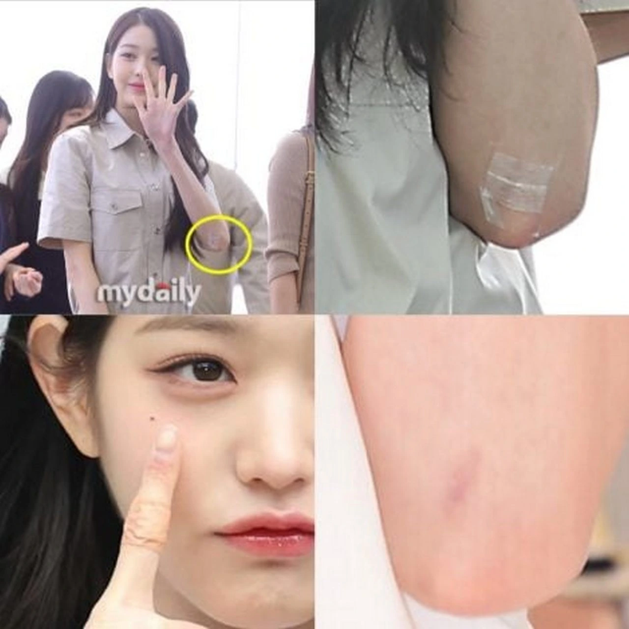 Starship Dikritik Sembunyiikan Cedera Jang Won Young & Terima 7 Jahitan Saat Syuting MV \'I Am\'
