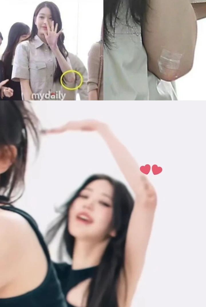 Luka Wonyoung IVE Diduga Lebih Parah Daripada yang Terlihat Saat di Bandara