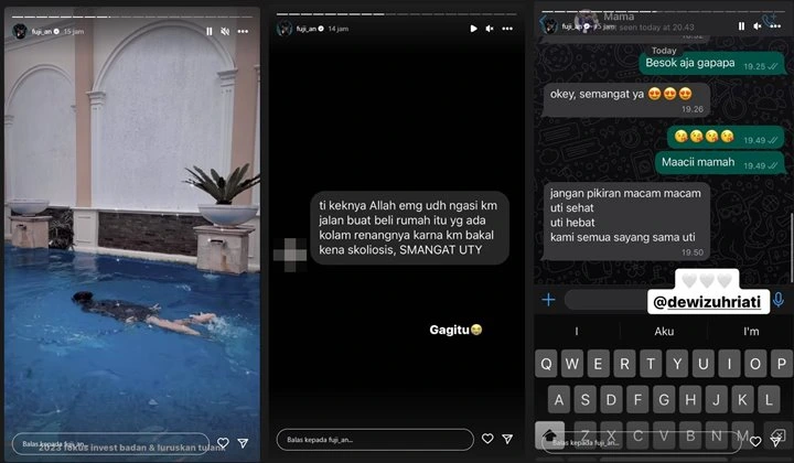 Fuji An Alami Tulang Belakang Bengkok, Nasihat Menyentuh Oma Dewi Terkuak