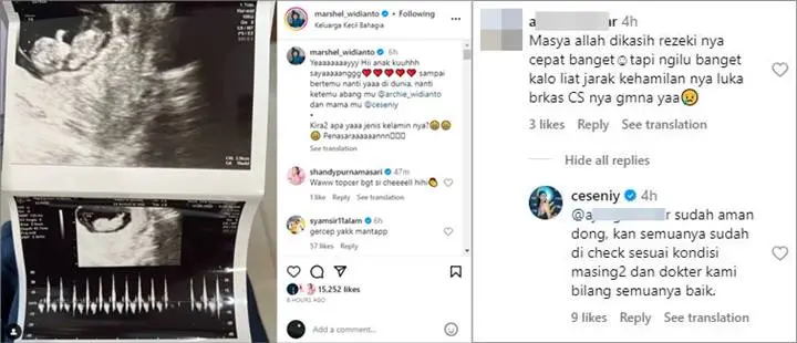 Dikhawatirkan Gegara Jarak Kehamilan Dianggap Terlalu Dekat, Istri Marshel Widianto Beri Penjelasan