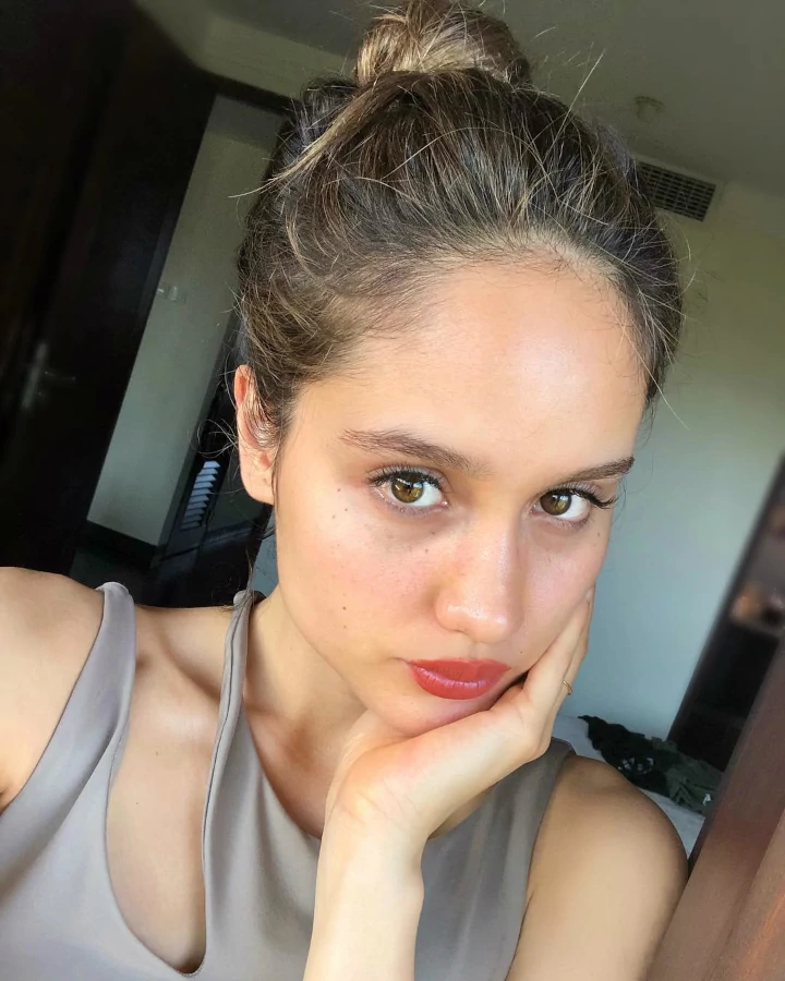 Tampilkan Freckles