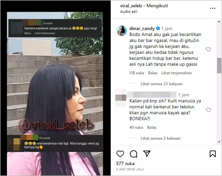 Dinar Candy Jawab Telak Usai Parasnya Digunjing Gegara Kamera Wartawan