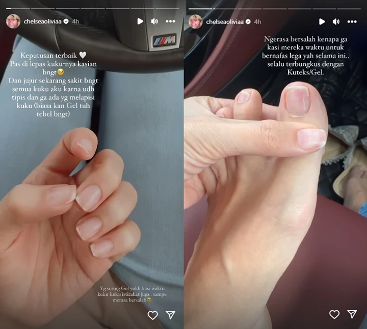 Chelsea Olivia Kesakitan Gegara Kebiasaan Pakai Kutek, Kondisi Kuku Tangan-Kaki Makin Tipis