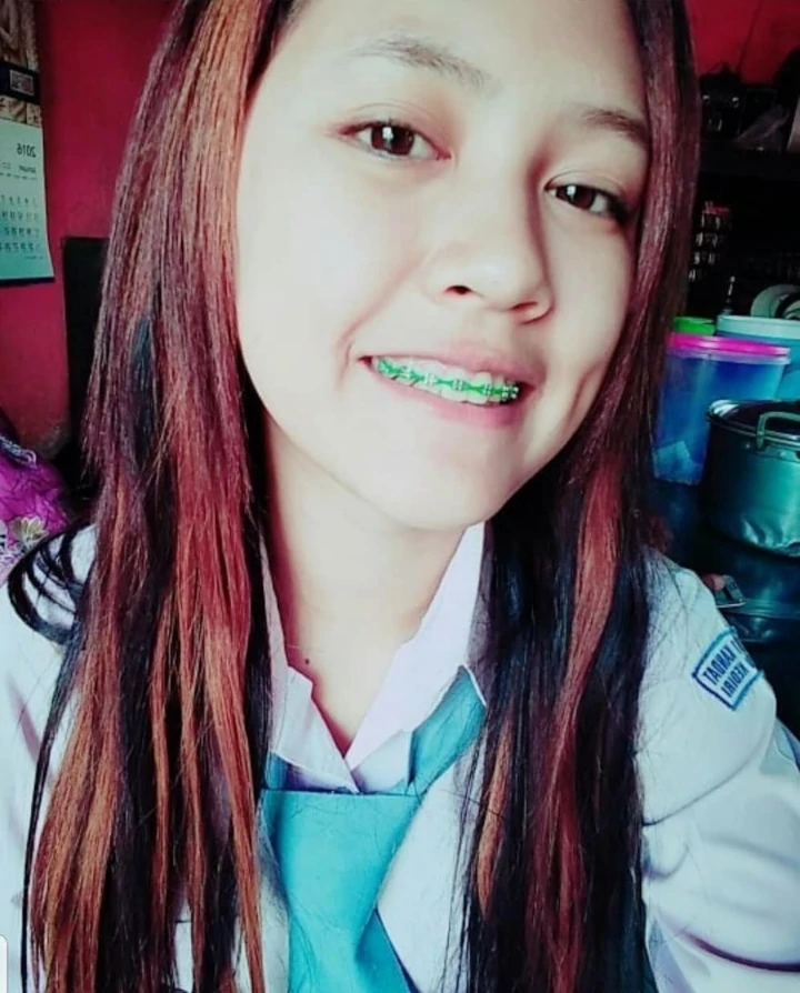 Pakai Behel Saat SMA