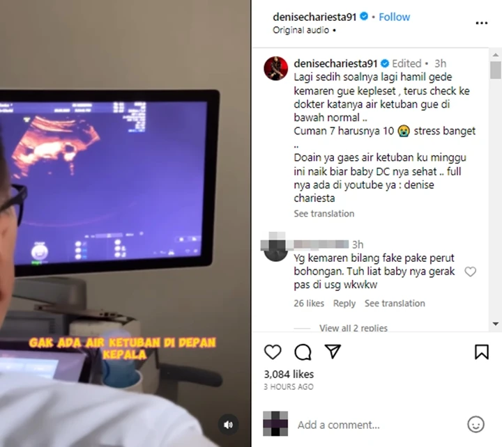 Denise Chariesta Kepleset Saat Hamil Besar, Kondisi Ketuban Memprihatinkan Denise Chariesta Kepleset Saat Hamil Besar, Kondisi Ketuban Memprihatinkan