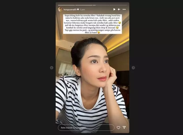 Bunga Zainal Tiba-tiba Bongkar Kondisi Kulitnya Tanpa Filter, Beri Pesan Menohok