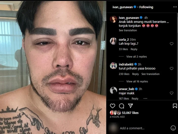Ivan Gunawan Mata Sembab Ngaku Habis Berantem