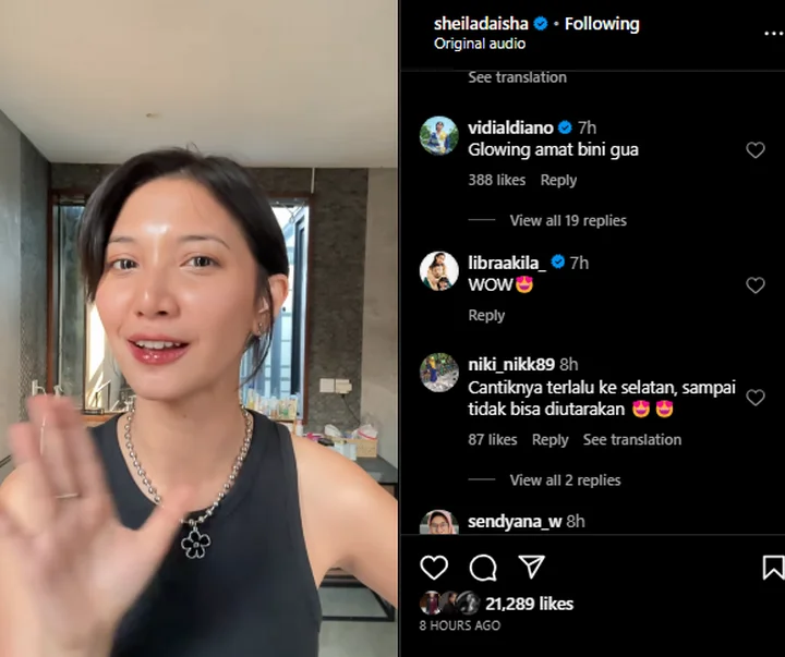 Vidi Aldiano Salfok Kulit Glowing Sheila Dara