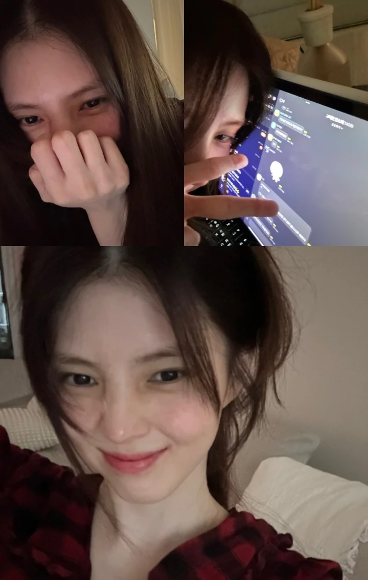 Han So Hee Pamerkan Hidung Pasca Operasi