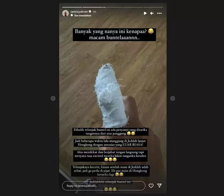 Tantri Kotak Ceritakan Kronologi di Balik Perban Jari Telunjuk