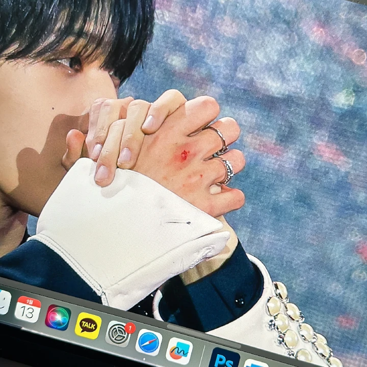 Tangan Jisung NCT Berdarah usai Alami Wardrobe Malfunction di Atas Panggung