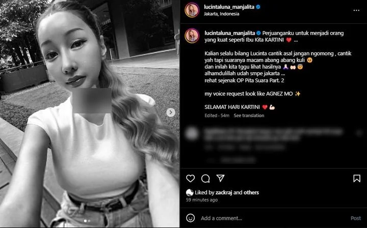 Lucinta Luna Pasca Operasi Pita Suara