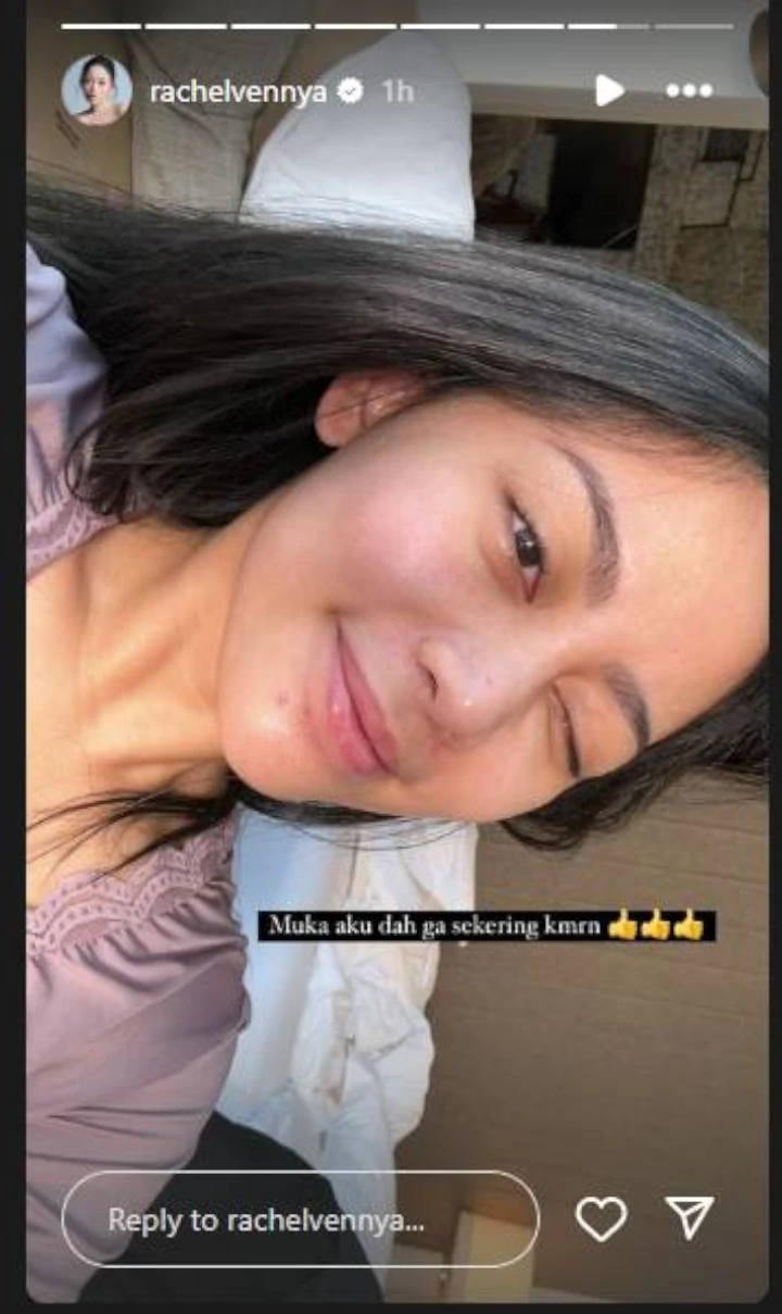 IG
