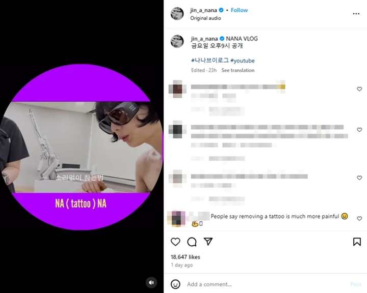 Nana Posting Video Menyakitkan saat Hapus Tato di Seluruh Tubuh
