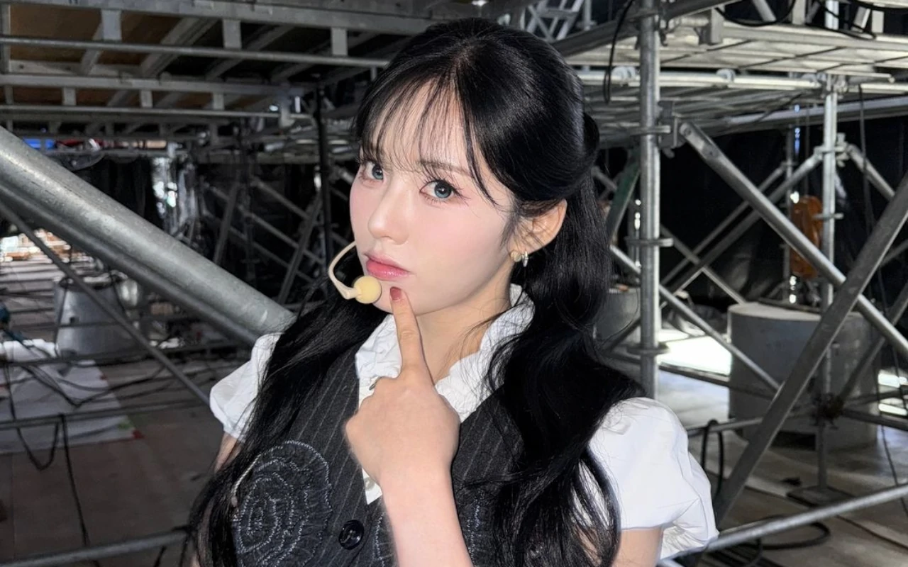 Pengakuan Jiwon fromis9 Pernah Cangkok Rambut Jadi Perbincangan Panas