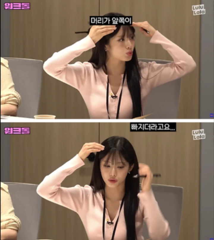 Pengakuan Jiwon fromis9 Soal Pernah Cangkok Rambut Jadi Sorotan