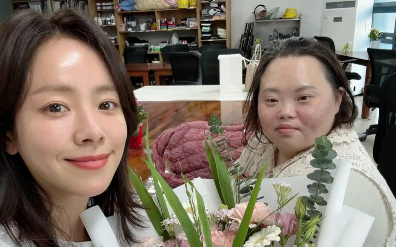 Jung Eun Hye Aktris Down Syndrome dari 'Our Blues' Umumkan Menikah