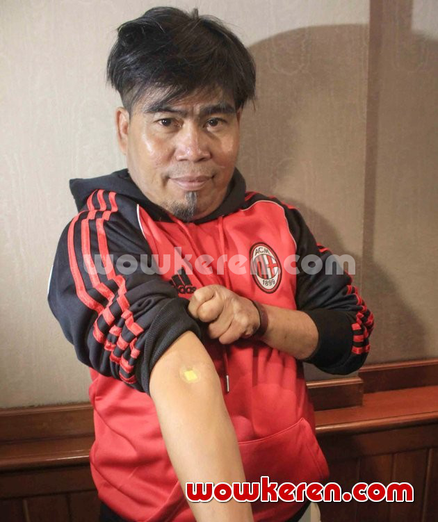 Gambar Foto Bopak Castello Saat Ditemui di RSCM, Jakarta