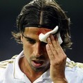 Sami Khedira melap dahinya yang  berdarah saat menghadapi Lyon di Liga Championss