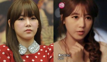 Reaksi Agensi Soyeon T-ara Dituduh Operasi Plastik Demi Video Musik
