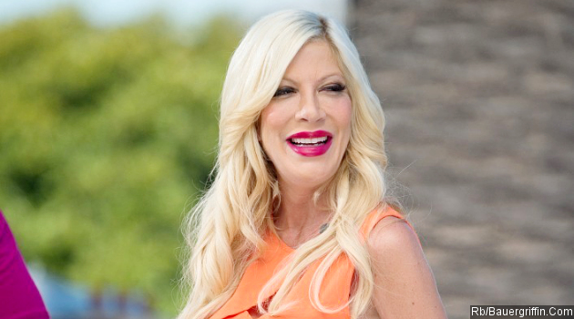 Jalani Cangkok Kulit Usai Lengan Terbakar Kondisi Tori Spelling Membaik