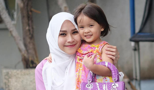 Jatuh dan Alami Luka di Kepala, Putri Zaskia Adya Mecca Dibawa ke UGD