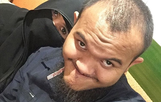 Berobat Penyakit Kulit ke Perancis, Istri Caisar 'YKS' Makin Membaik