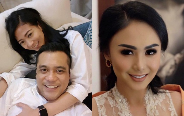 Chico Hakim Resmi Nikahi Balerina Cantik, Yuni Shara Pamer Bahagia Dicium Cowok