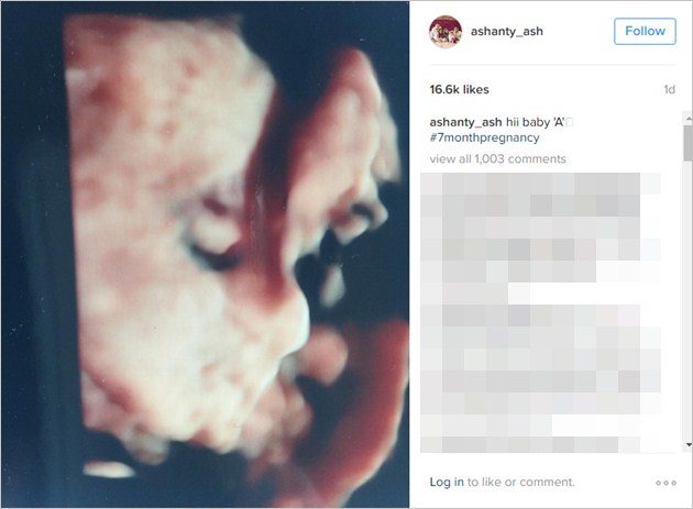 Ashanty 'Sapa' Calon Anak