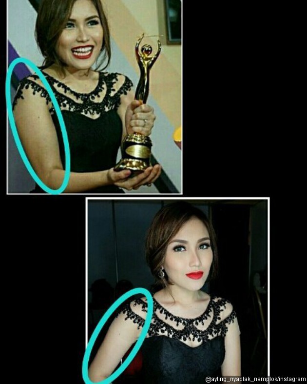 Ayu Ting Ting