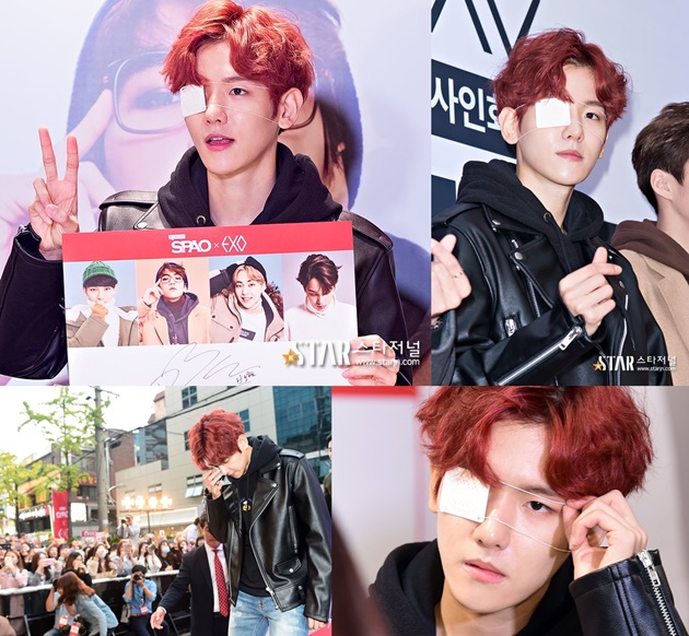Baekhyun Cedera Mata