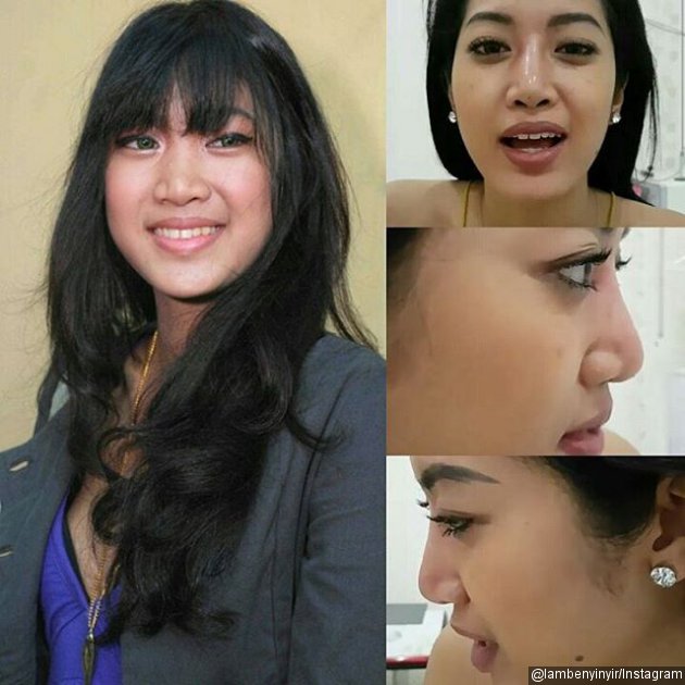 Widy Vierratale