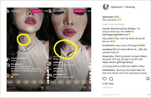 Foto Leher Lucinta Luna Disoroti Netter, Ada Sisa Jakun?