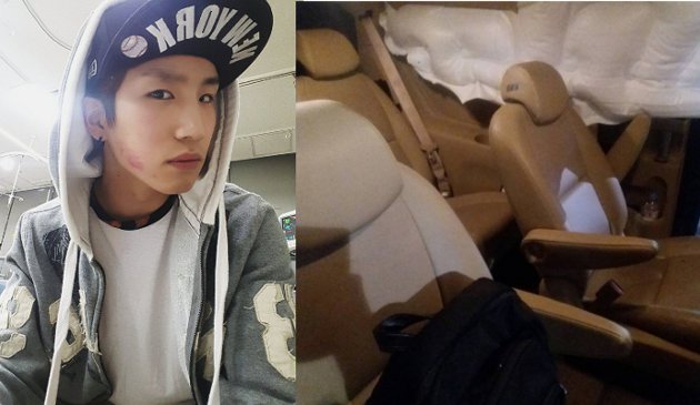 Alami Kecelakaan Mobil, 24K Posting Selfie