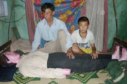Pria di Vietnam Tidur dengan Mayat Istrinya