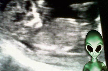 Wanita di Skotlandia Mengandung 'Alien'