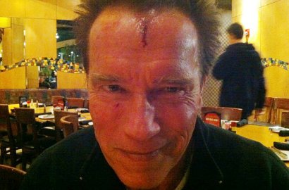 Kepala Arnold Schwarzenegger Terluka Saat Syuting 'The Last Stand'