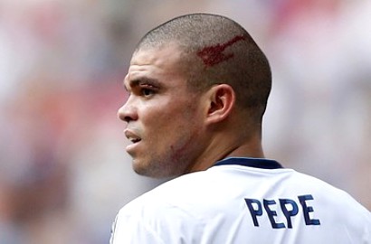 Cedera Kepala, Pepe Absen Bela Real Madrid di El Clasico