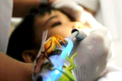 Dokter Indonesia Ciptakan Bor Gigi Bermusik