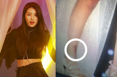 Terluka di Konser Beijing, Suzy miss A Tetap Tampil Profesional