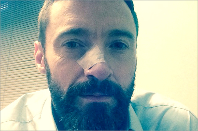 Hugh Jackman Kembali Jalani Perawatan Kanker Kulit